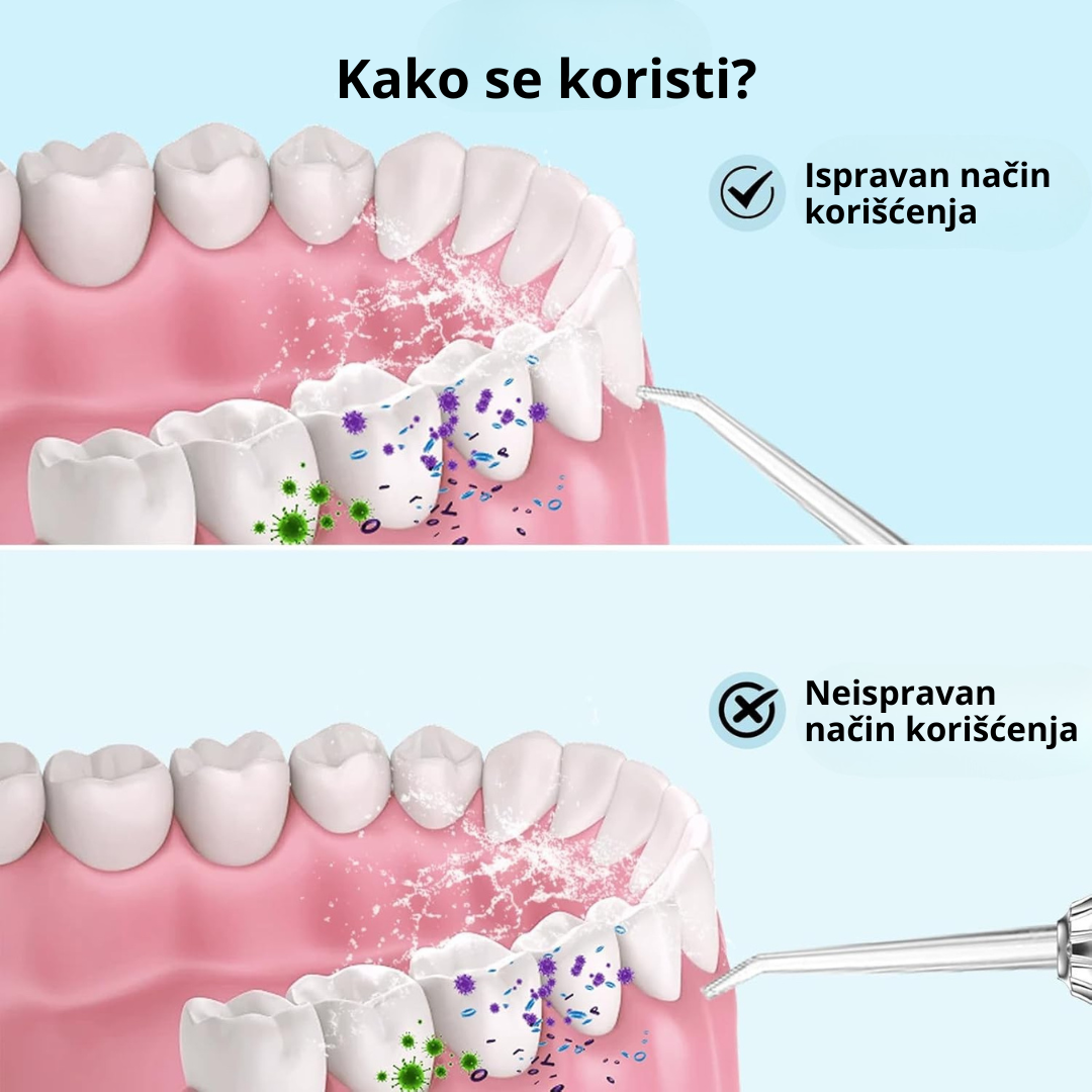 Irigator za ispiranje zuba i desni