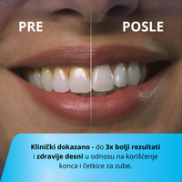 Irigator za ispiranje zuba i desni